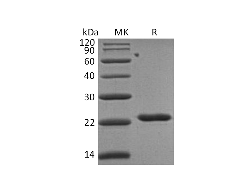 Recombinant Human TIMP-2 (C-6His)