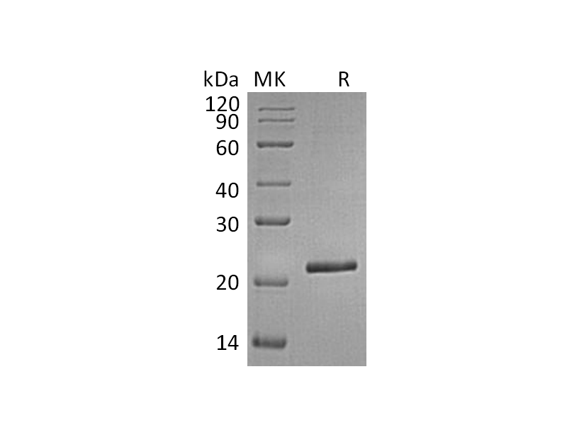 Recombinant Human TIMP-4 (C-6His)