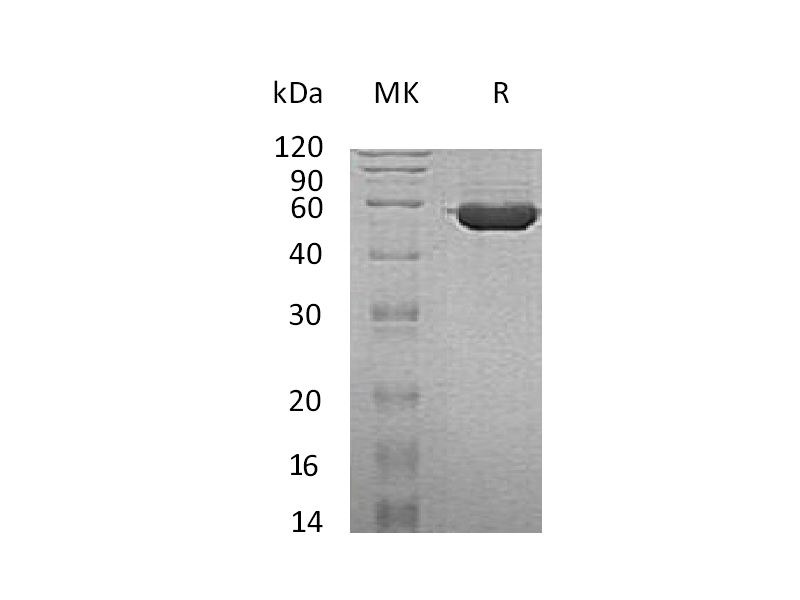 Recombinant Human TINAGL1 (C-6His)