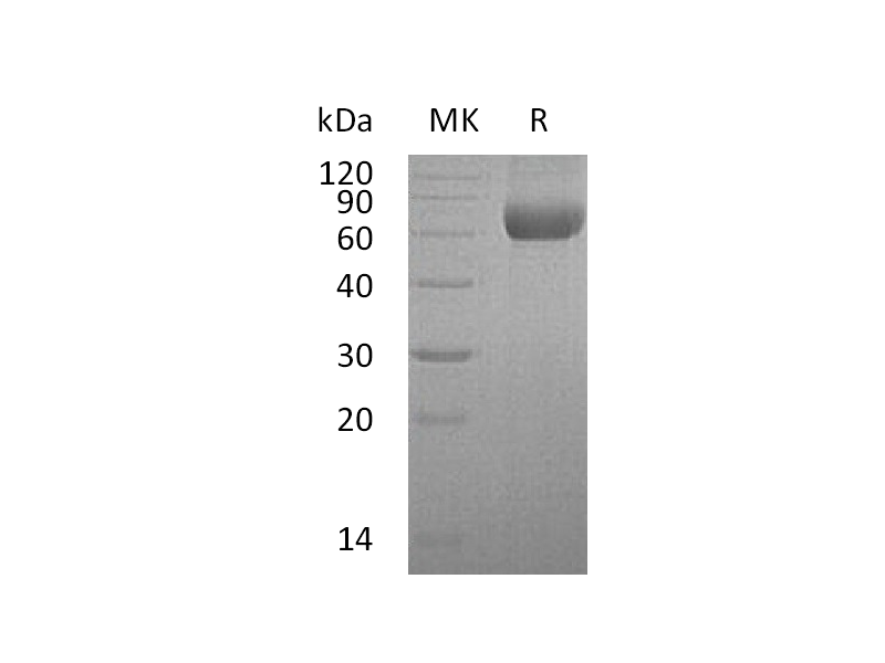 Recombinant Human HATL5 (C-6His)
