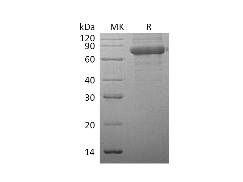 Recombinant Human TPP1 (C-6His)