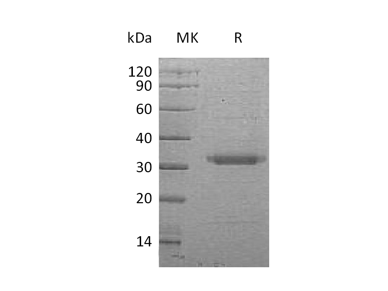 Recombinant Human BSSP-4 (C-6His)