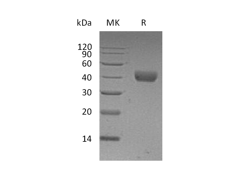Recombinant Human CD38 (C-6His)
