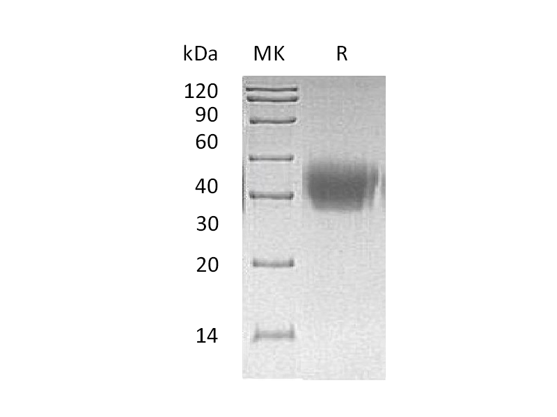 Recombinant Human ACVR2A (C-6His)