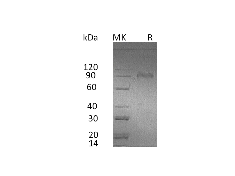 Recombinant Human AMIGO2 (C-Fc)