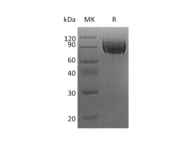 Recombinant Human VEGFR2 (C-6His)