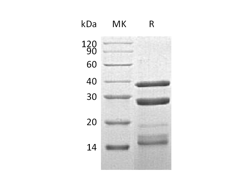Recombinant Human CTSS (C-6His)