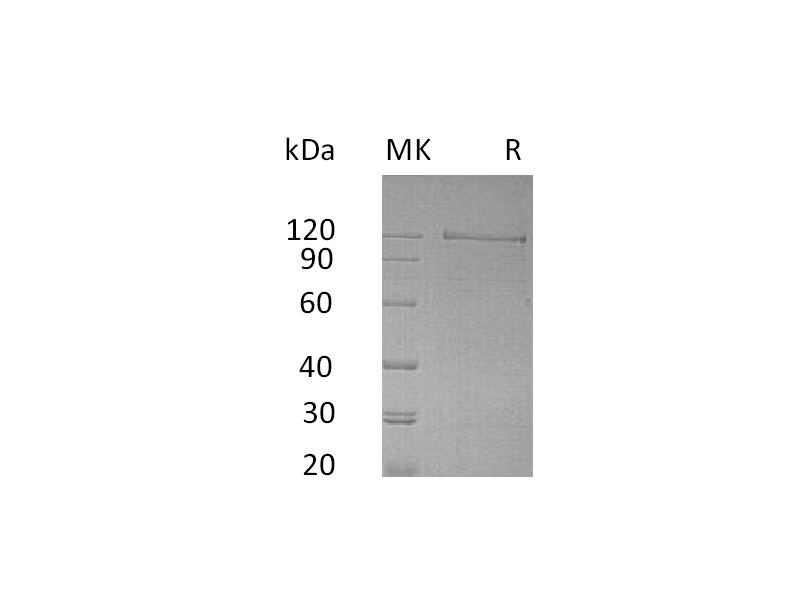 Recombinant Human NRCAM (C-Fc)