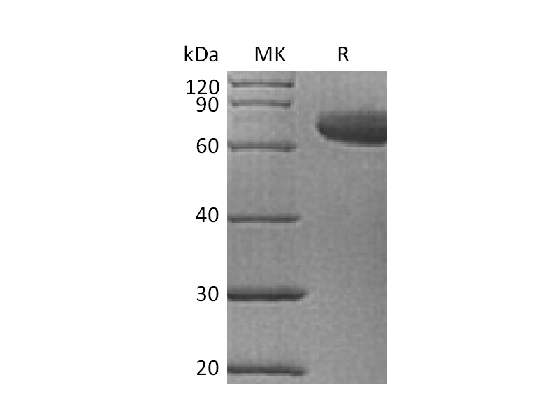 Recombinant Human IL-23 (C-6His)