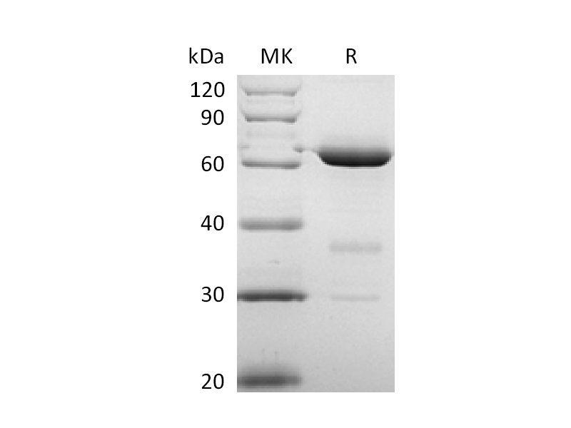 Recombinant Human CD73 (P21589, C-6His)