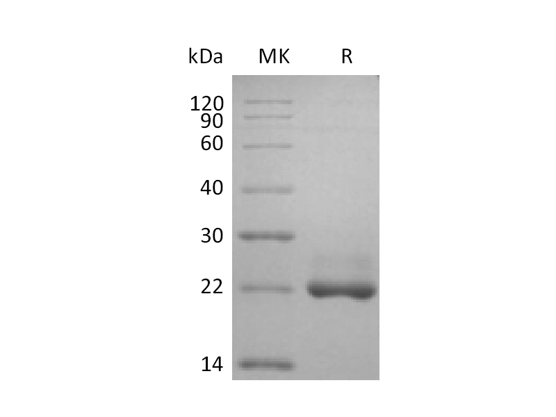 Recombinant Human BAFF (N-6His)