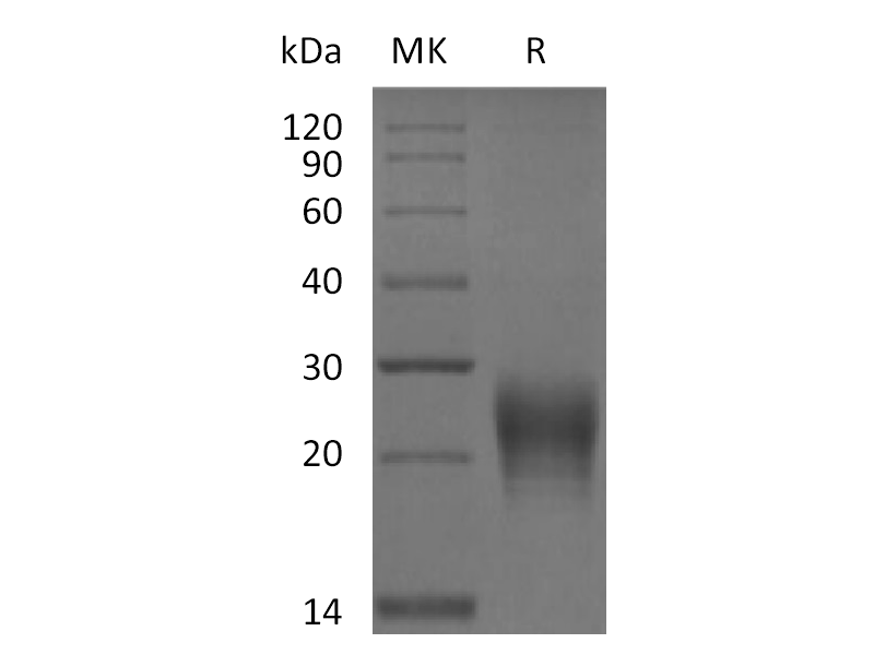 Recombinant Human Fas Ligand (N-6His)