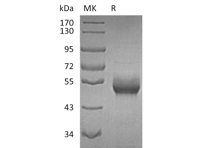 Recombinant Human B4GALT1 (C-6His)