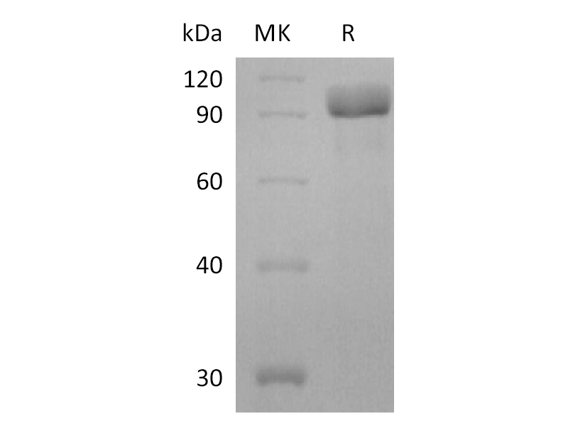 Recombinant Human HER3 (C-6His)