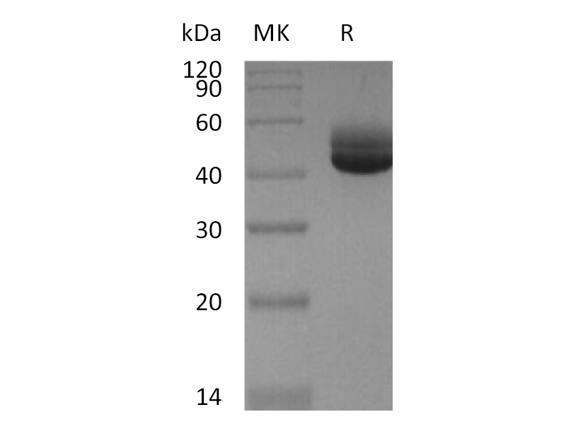 Recombinant Human IL-4 (C-Fc)