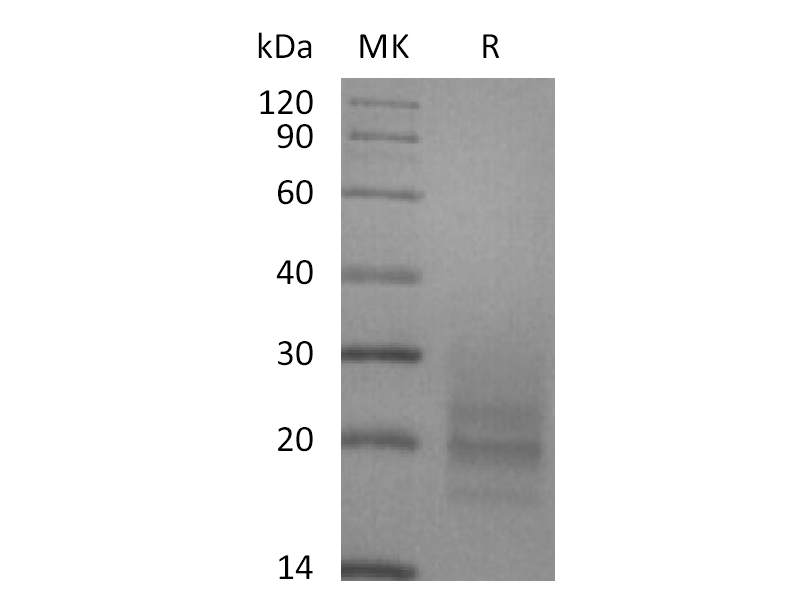 Recombinant Human CD3D&CD3E Heterodimer (C-6His)