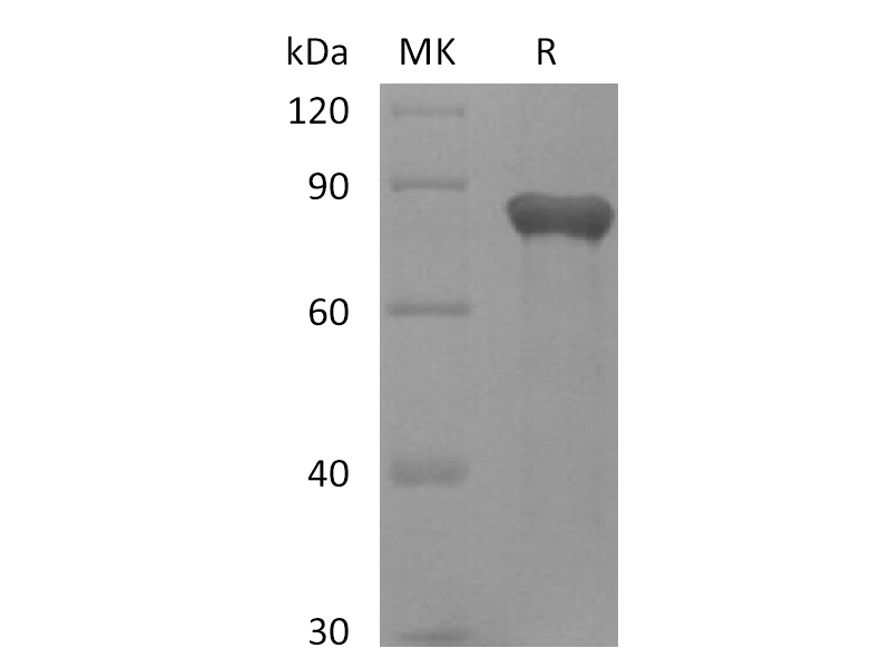Recombinant Human GAS6 (C-6His)