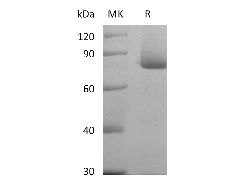 Recombinant Human Nectin-4 (C-mFc)