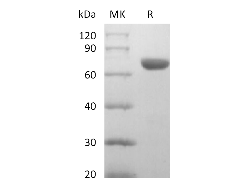 Recombinant Human EphA8 (C-6His)