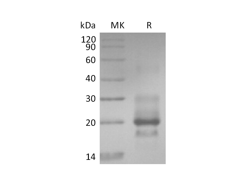 Recombinant Human TRAIL R1 (C-6His）