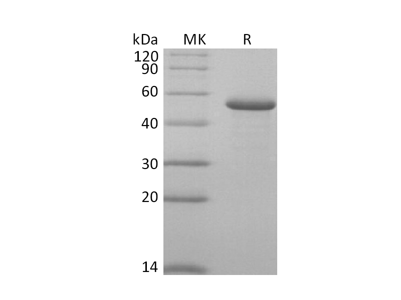 Recombinant Human RCN2 (C-6His)