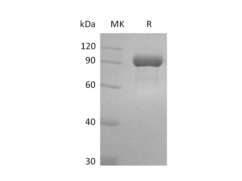 Recombinant Human FAP (N-8His)