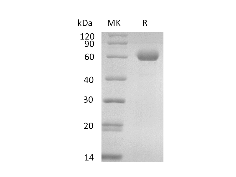 Recombinant Human CD39L1 (C-6His)