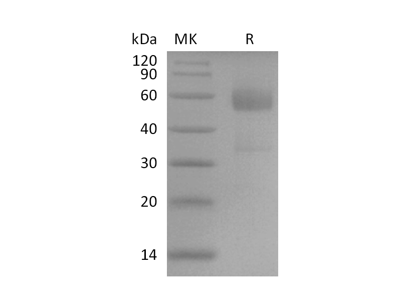 Recombinant Human TREM2 (C-mFc)