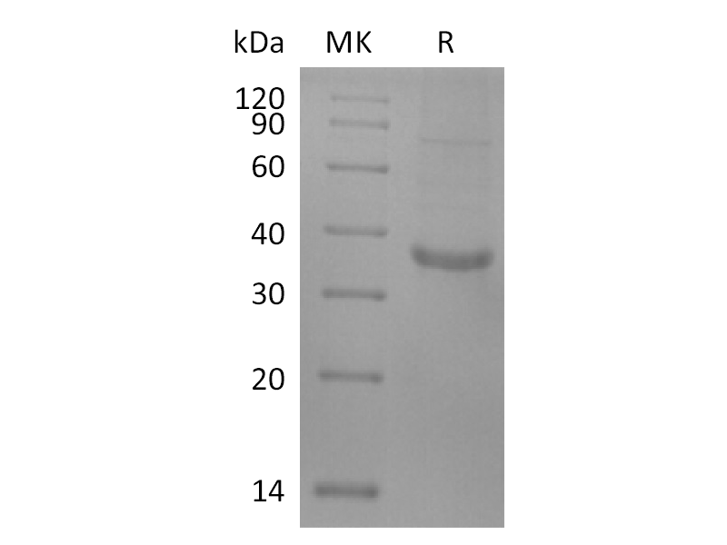 Recombinant Human CD20 (C-Flag)