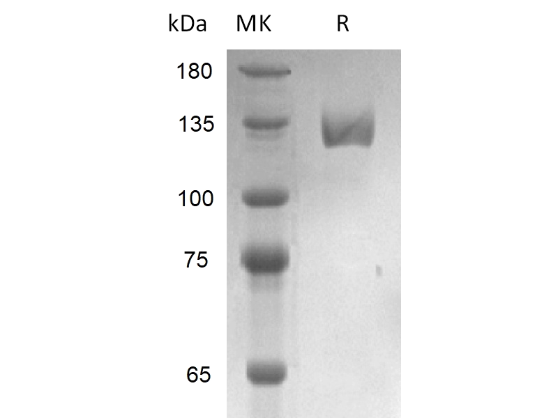 Recombinant Human PSMA (N-Fc)