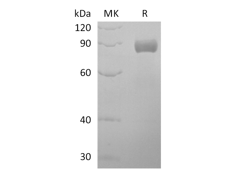 Recombinant Human EDIL3 (C-Fc)