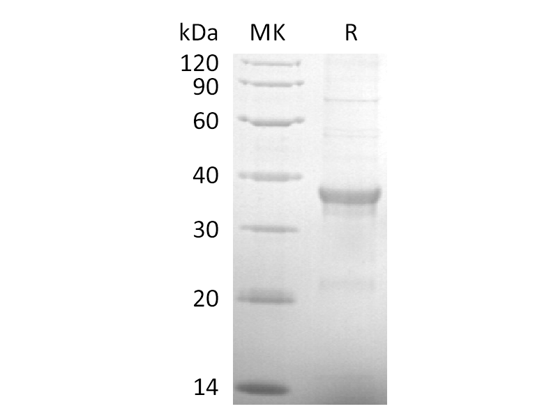 Recombinant Human CD20 (C-6His-Flag)