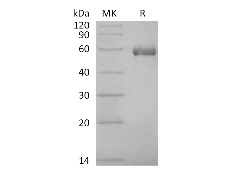 Recombinant Human HLA-A*0201 HBs Ag complex Protein (C-10His)