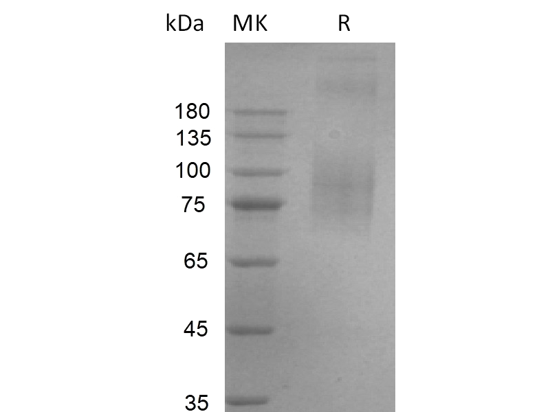 Recombinant Human NaPi2b (C-6His-Flag)