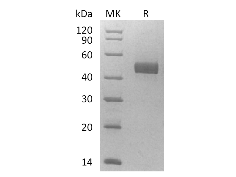 Recombinant Human DLL3 (C-6His)