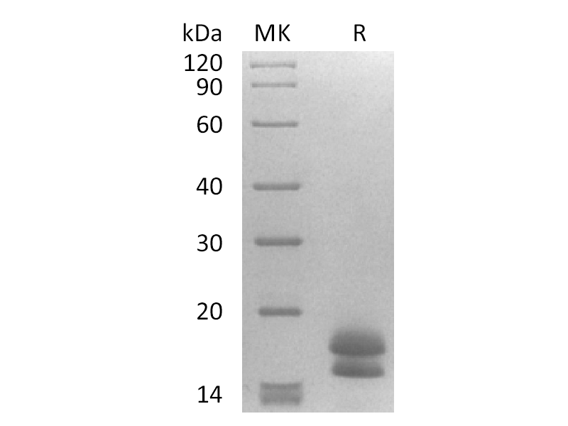 Recombinant Human DLL3 (353-492, C-6His)