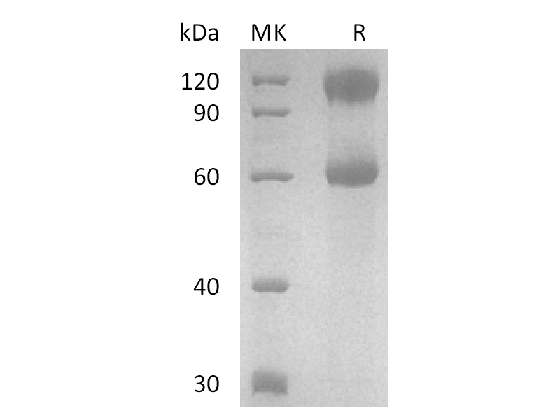 Recombinant Human IL-2 R beta&IL-2 R alpha&IL-2 R gamma  Heterotrimer Protein (C-Fc)