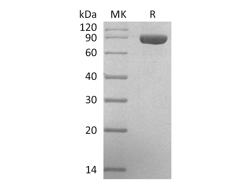 Recombinant Human GUSB  (C-6His)