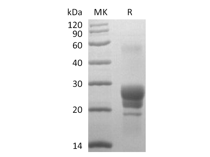 Recombinant Human TL1A  (N-6His)