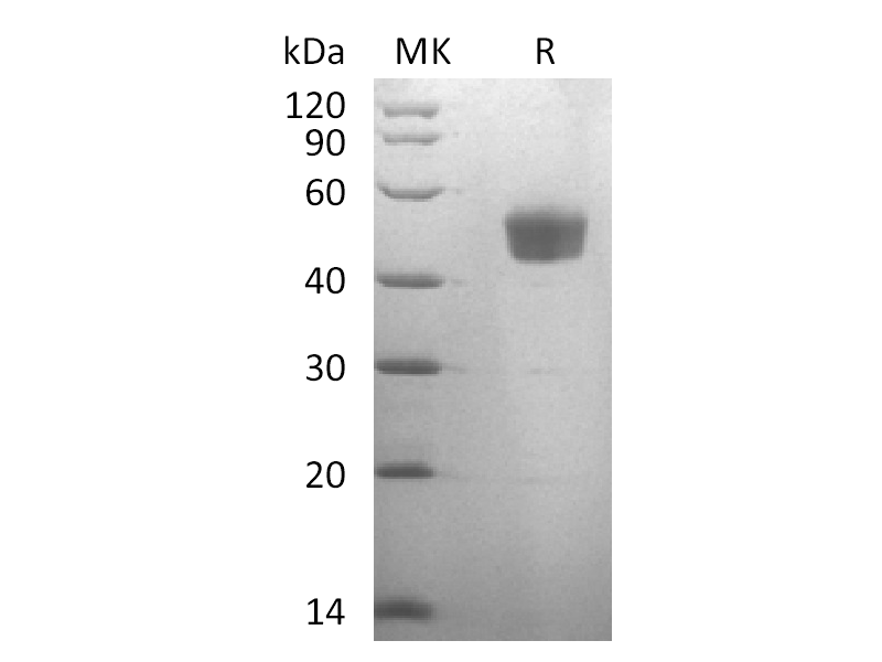 Recombinant Human GIPR N-ECD (C-Fc)
