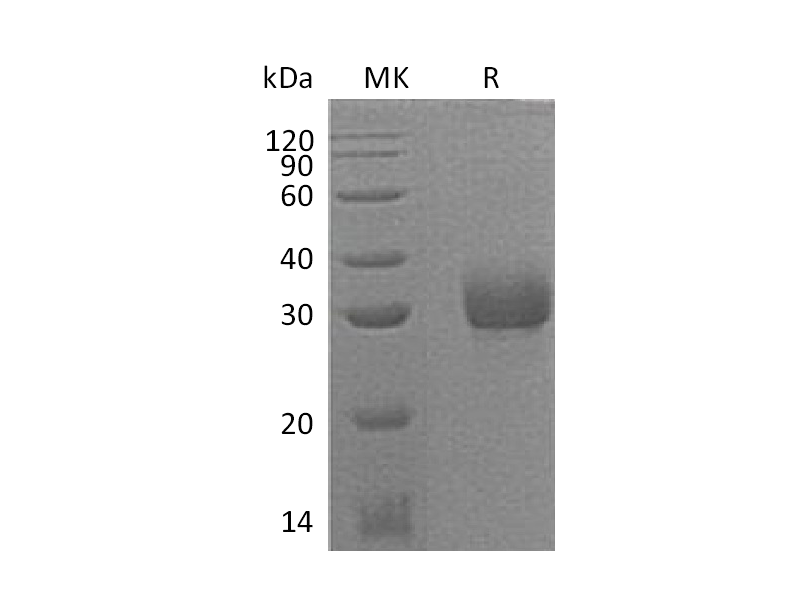 Recombinant Mouse Acrp30 (C-6His)