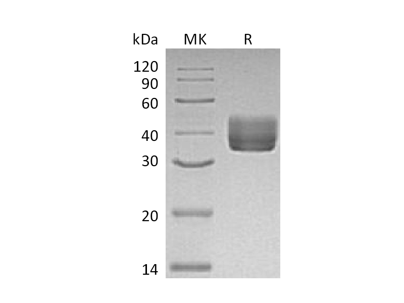 Recombinant Mouse CD157 (C-6His)