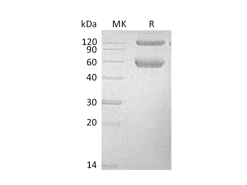Recombinant Mouse BMPR1A (C-Fc-6His)