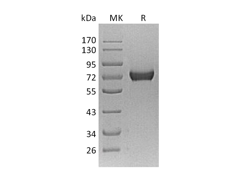 Recombinant Mouse AFP (C-10His)