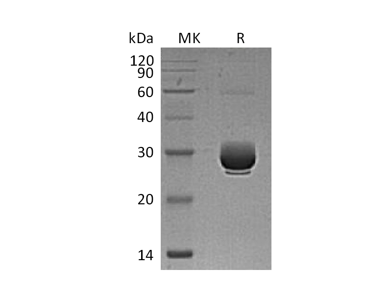 Recombinant Mouse ANGPTL3 (C-6His)