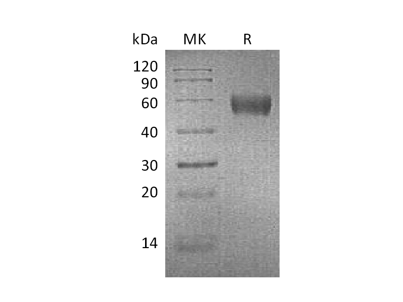 Recombinant Mouse ApoH (C-6His)