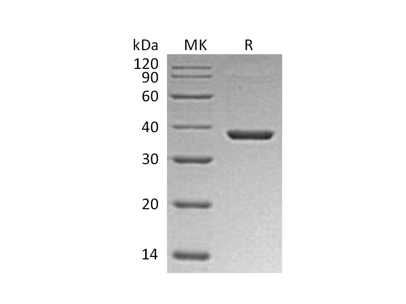 Recombinant Mouse B7-H3 (C-6His)