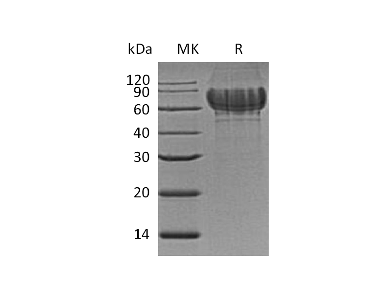 Recombinant Mouse IBSP (C-6His)