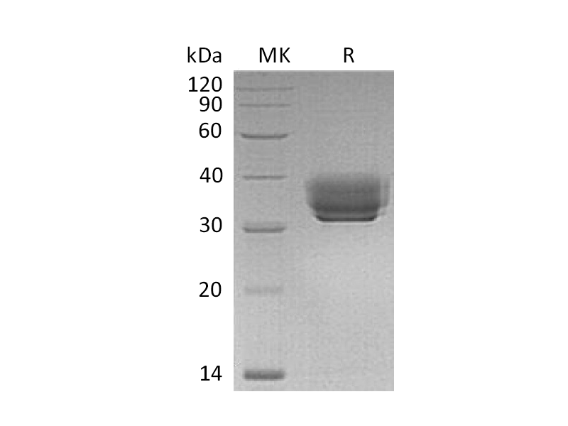 Recombinant Mouse BTN1A1 (C-6His)