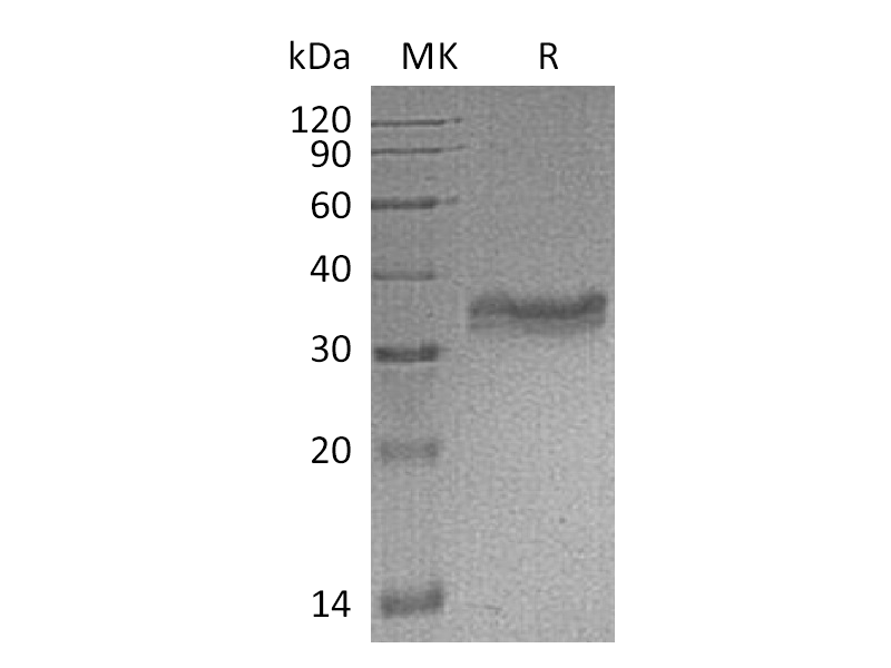 Recombinant Mouse Carbonic Anhydrase 4 (C-6His)